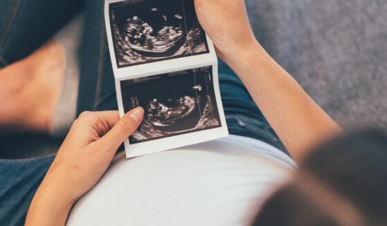 Pregnant woman holding ultrasound photo.
