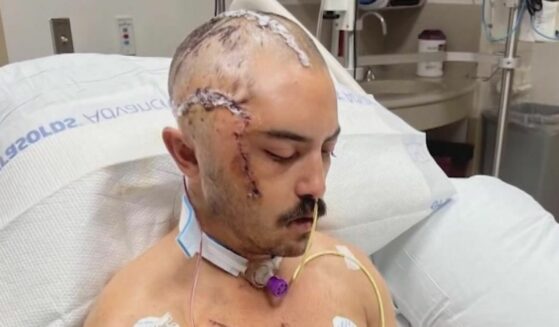 Juan Carlos La Verde in the hospital after suffering an alligator attack while swimming in a lake near Tampa, Florida.